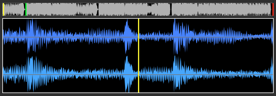 audio waveform